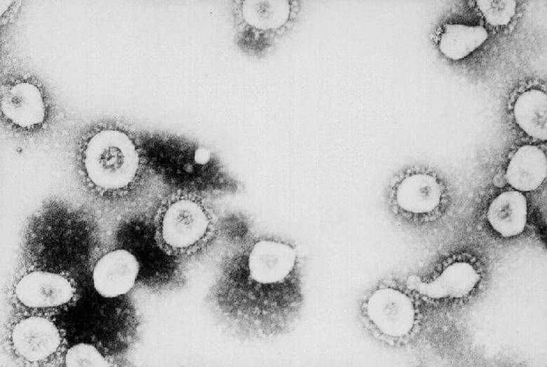 Coronavirus