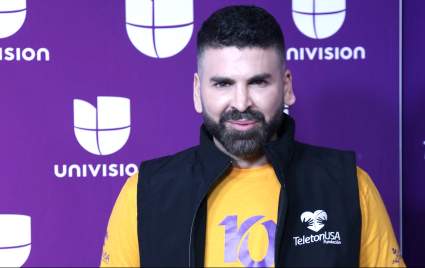 Jomari Goyso cuestiona  productos para alisar el cabello: ¿Qué problemas causa en la salud?