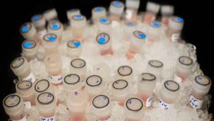 Un miembro de la familia Kardashian dirige su batalla ‘Scary’ con el cáncer