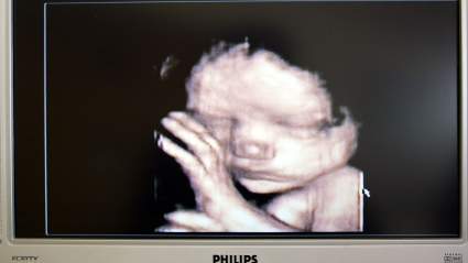 La estrella principal ‘mamá adolescente’ confirma embarazo